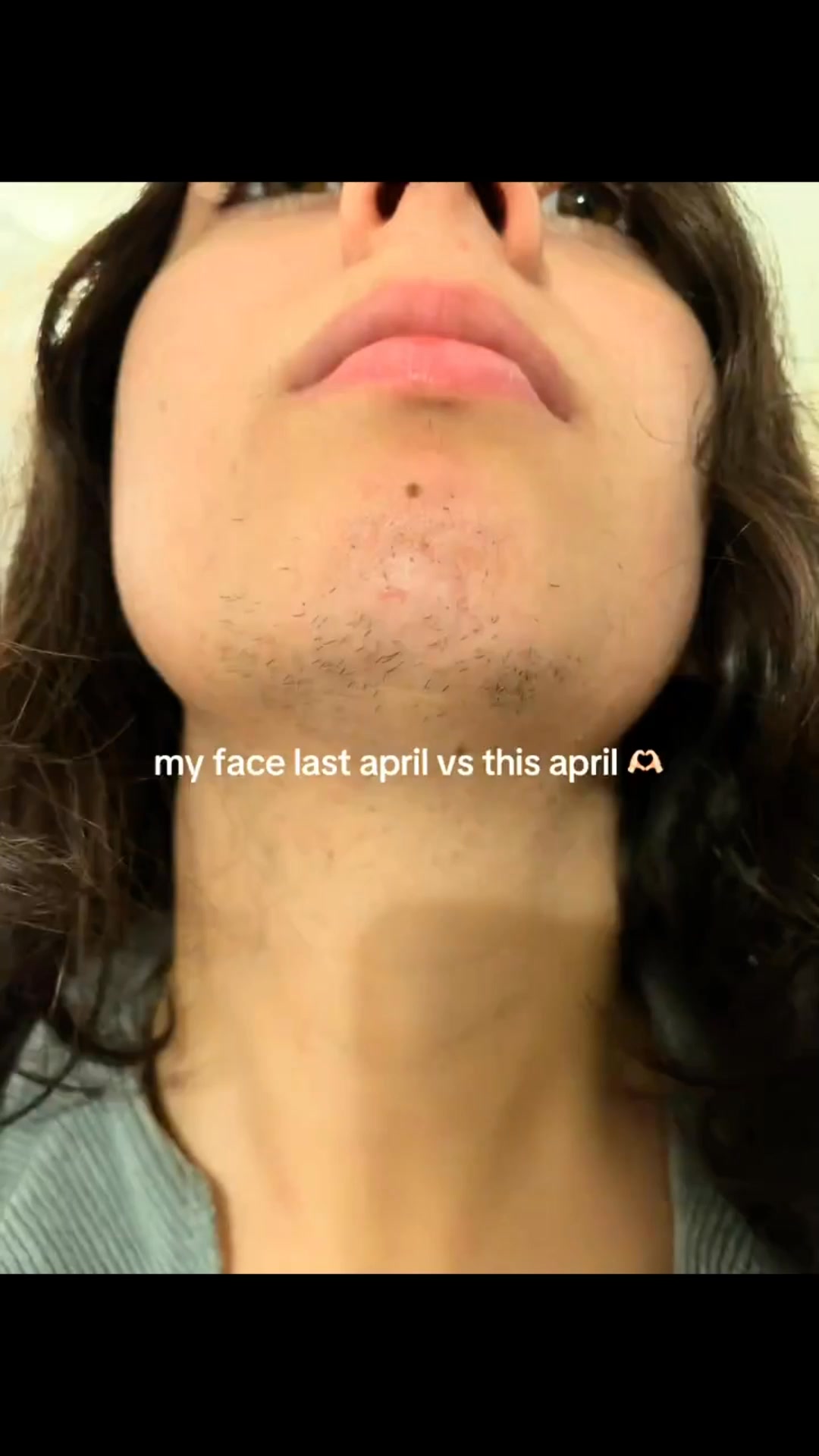 Stop Shaving, Start Living!