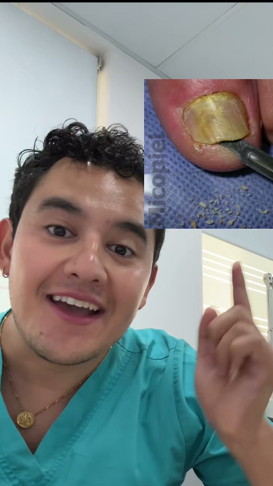 El aceite llega donde la crema no