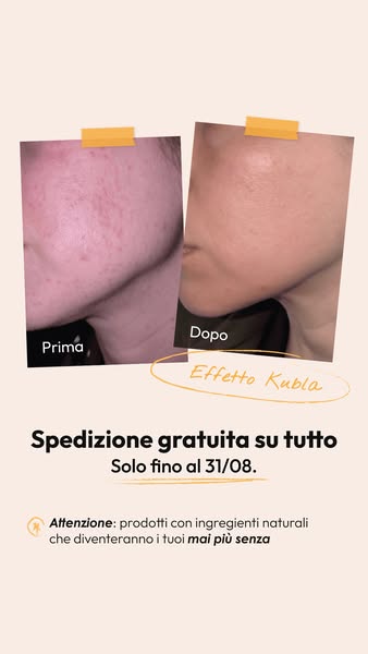 Crea il tuo Kit e approfitta della doppia promo