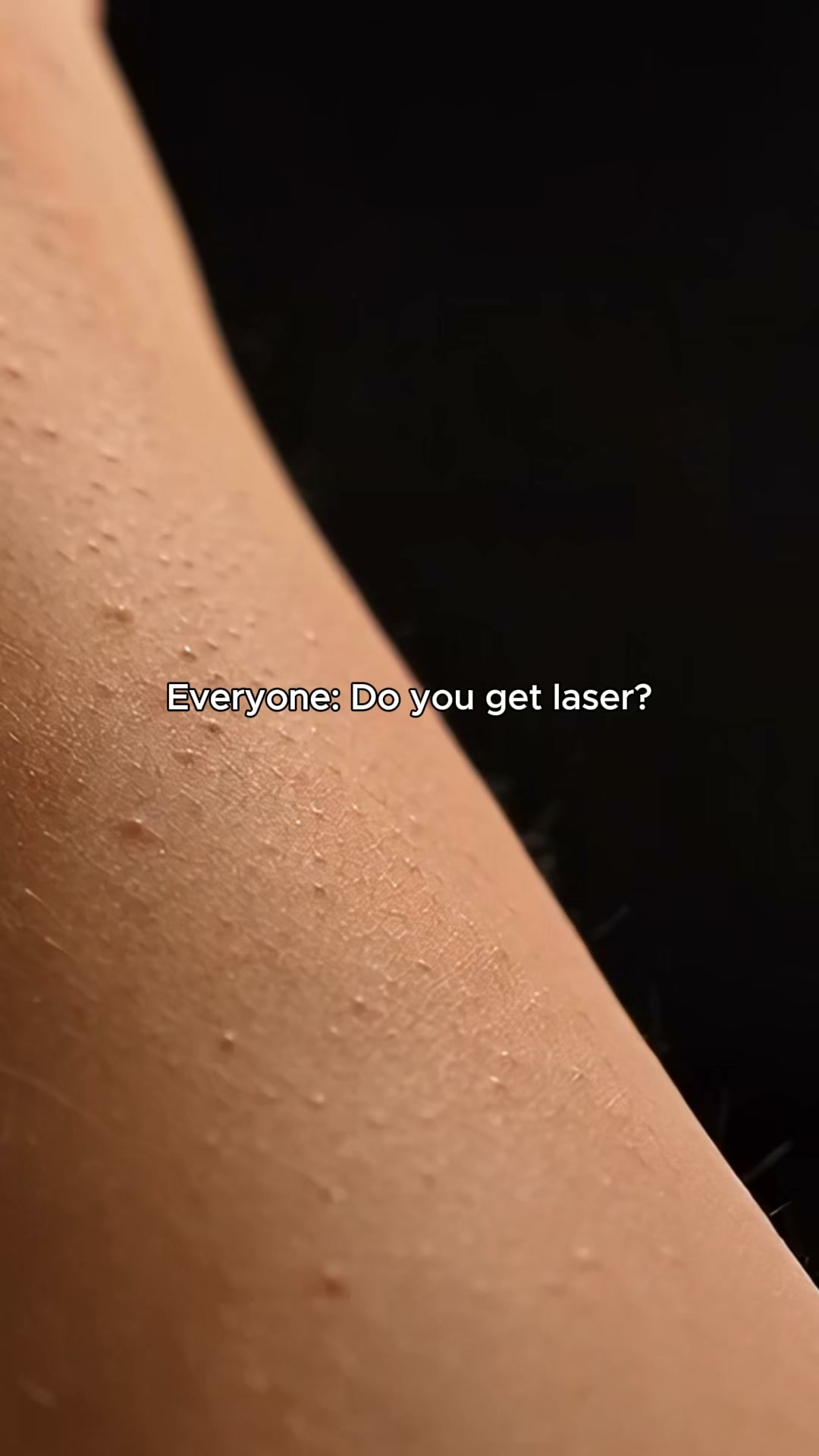 Laser free formula