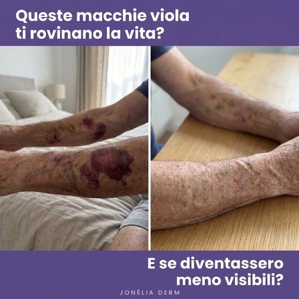 Siero Derma Restore