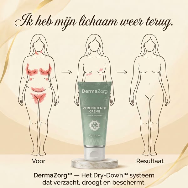 Stop jeuk, roodheid en irritatie in huidplooien.