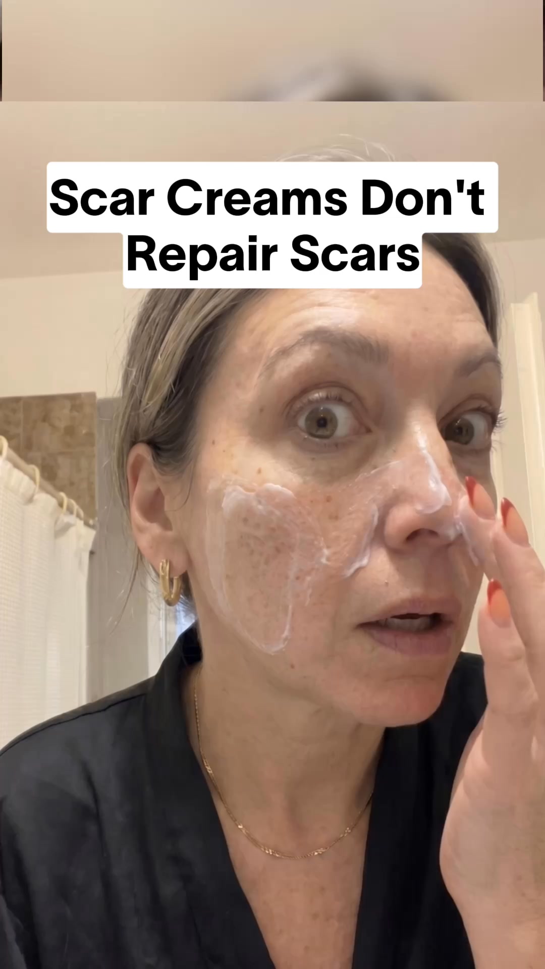 The Salmon DNA Repair Hack for Acne Scars