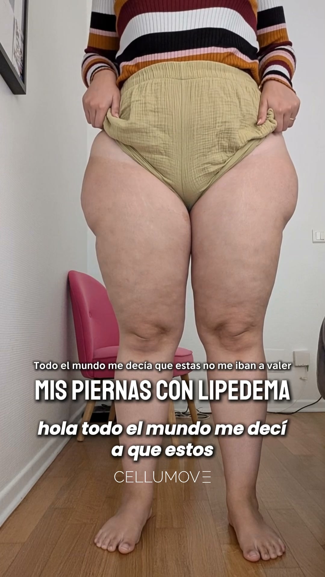 Comience hoy mismo a aliviar su lipedema.