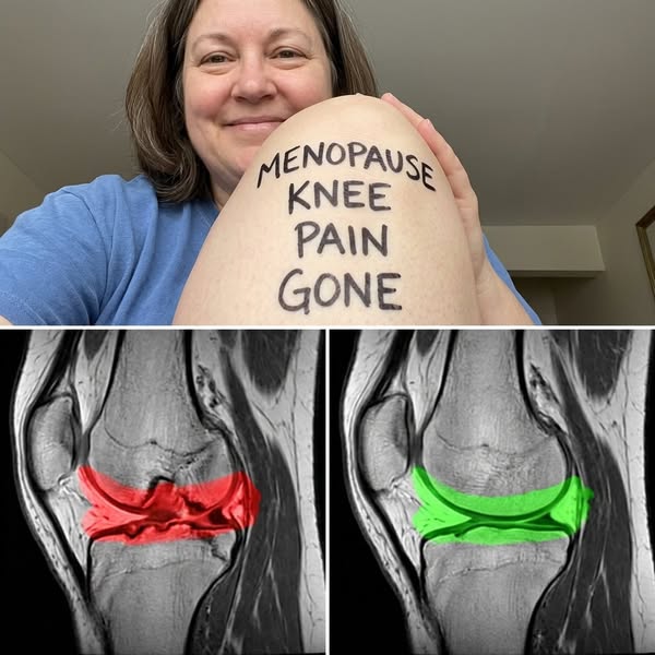 Joint pain after menopause isn't inevitable: The overlooked connection between aging and cellular repair that is…