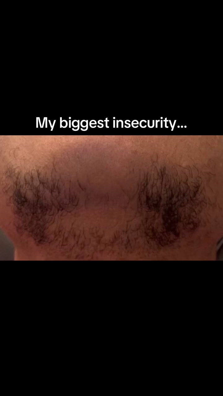 The serum that replaces minoxidil | 70% OFF Today
