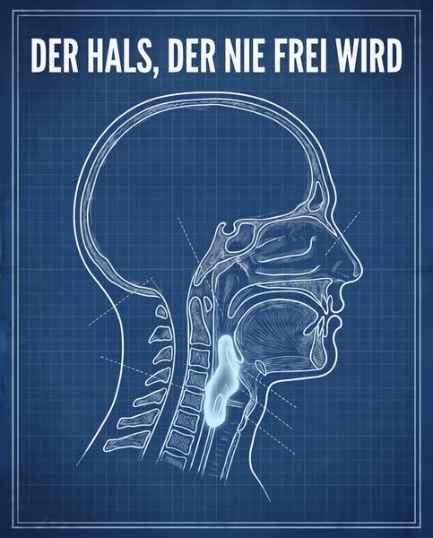 Kein Sodbrennen. Nur ein Husten, den sich niemand erklären kann. Bis jetzt.