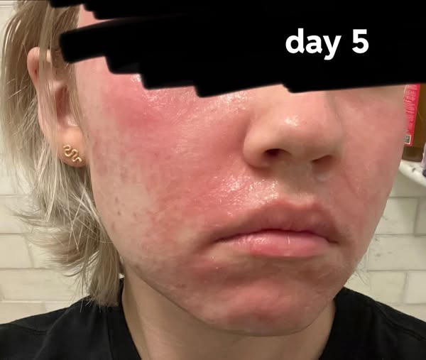 Read this if your skin is betraying you.