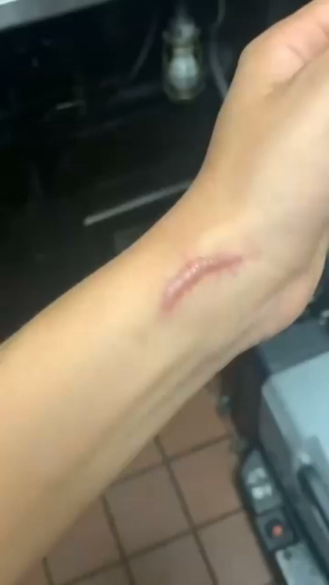 The Scar Patch Dermatologists Don’t Want You to Miss