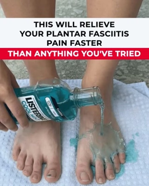 Stop Plantar Fasciitis Pain By Tomorrow Morning!