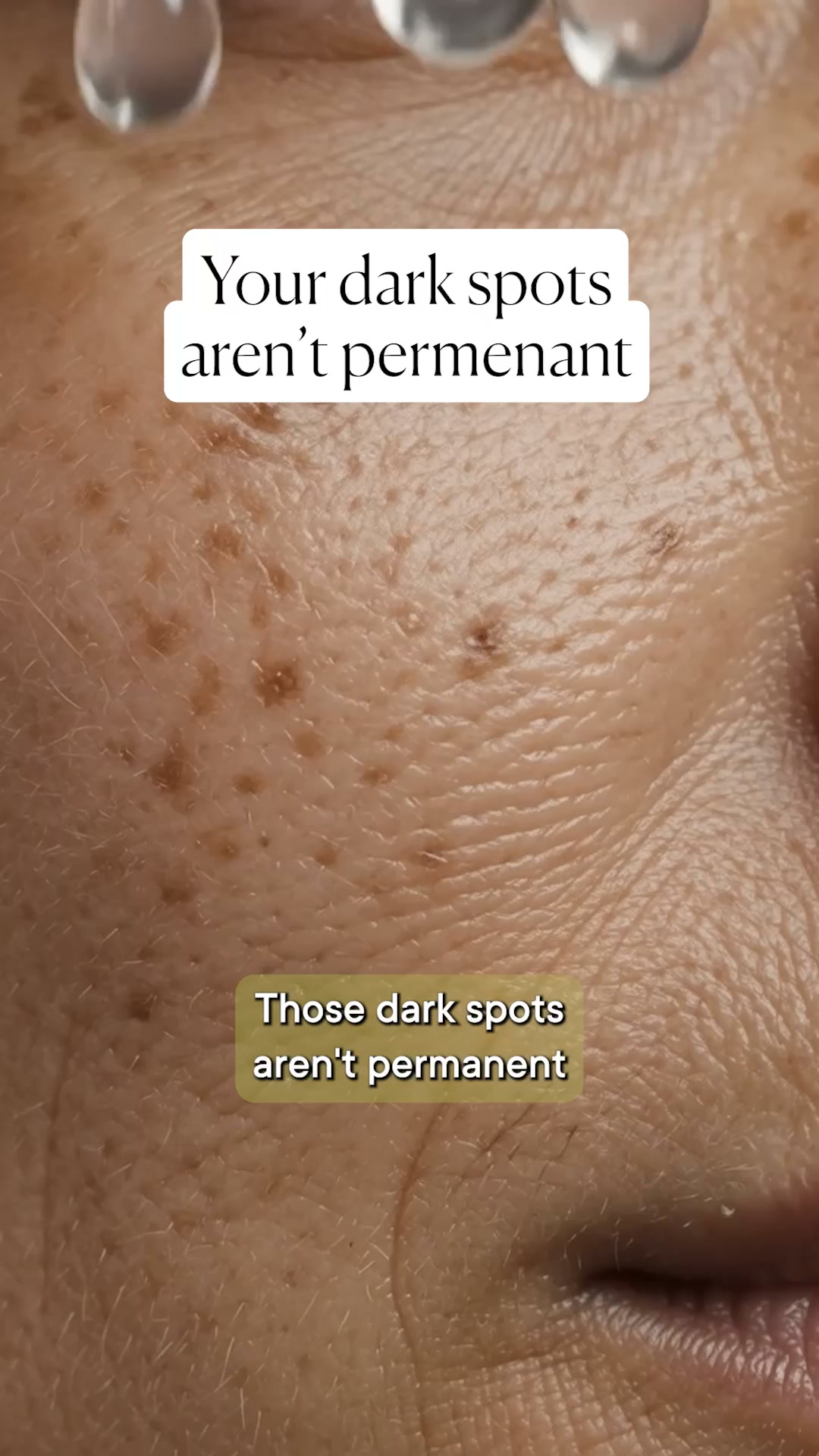 Those dark spots aren't permanent. Your serum just can't reach them.