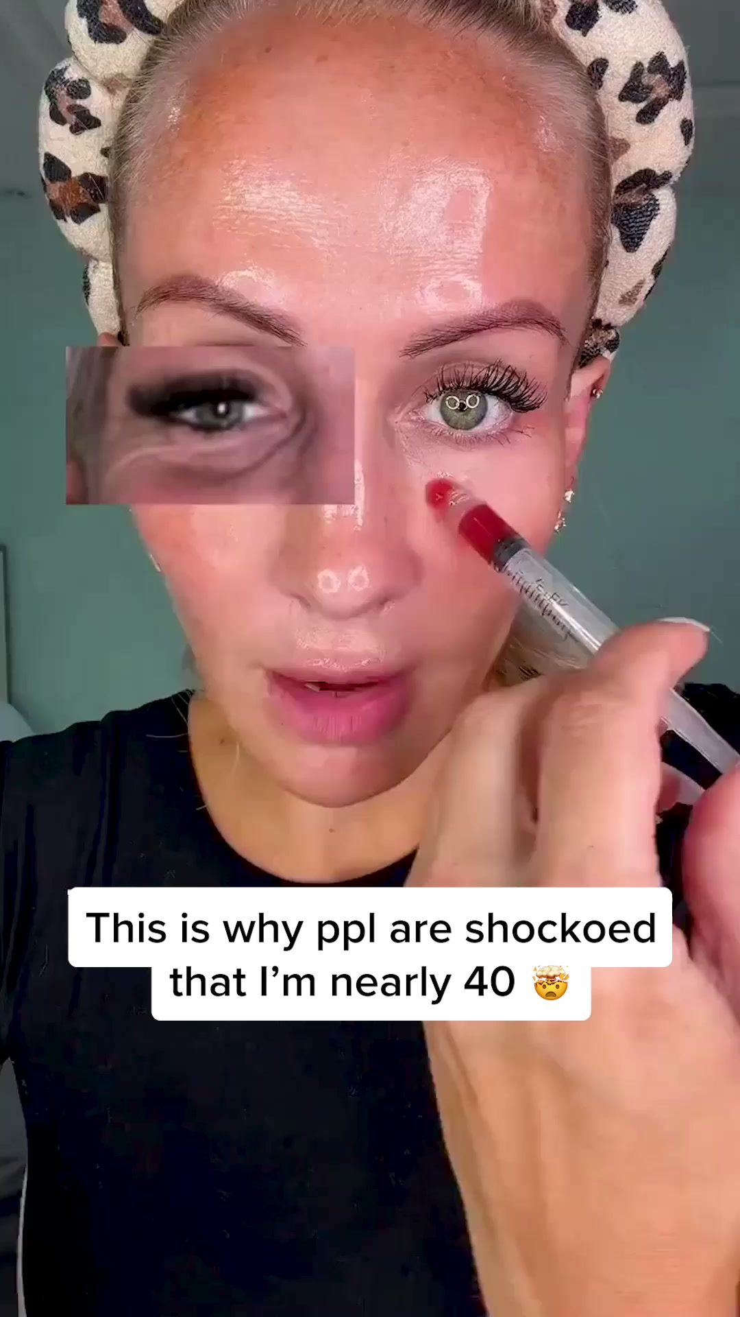 Why Women 40+ Are Choosing GHK-Cu Over Botox