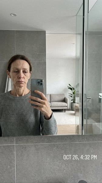 How I Fixed My “Ozempic Face”