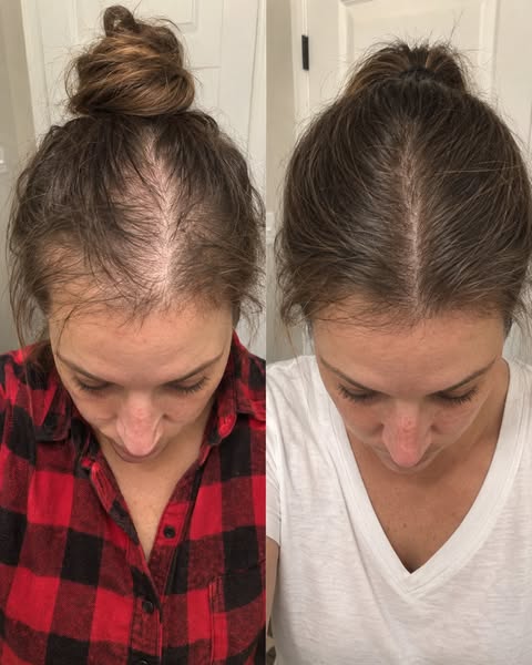 Read This If Your Hair Is Thinning