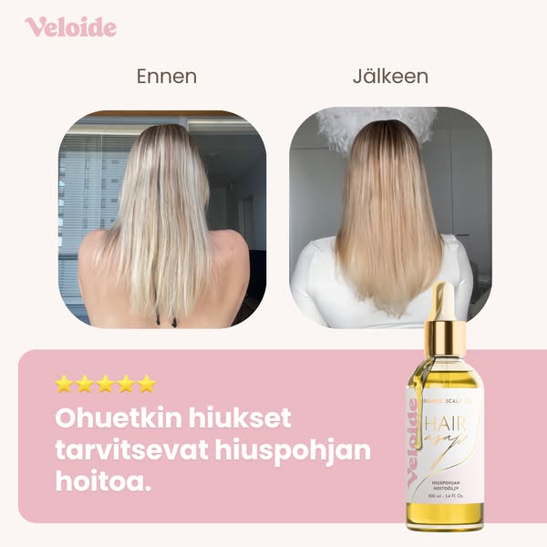 Ohuetkin hiukset tarvitsevat hiuspohjan hoitoa.