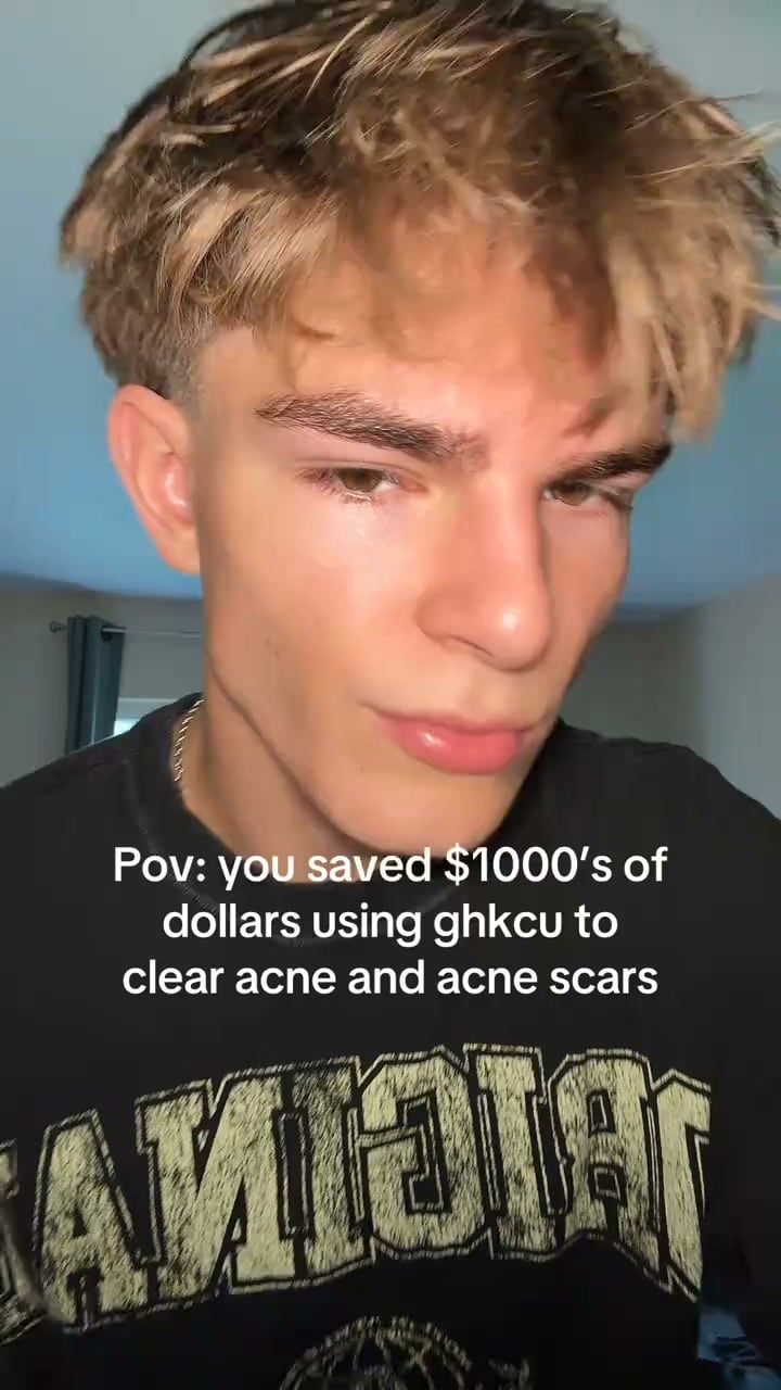 Clearer Skin Starts Here