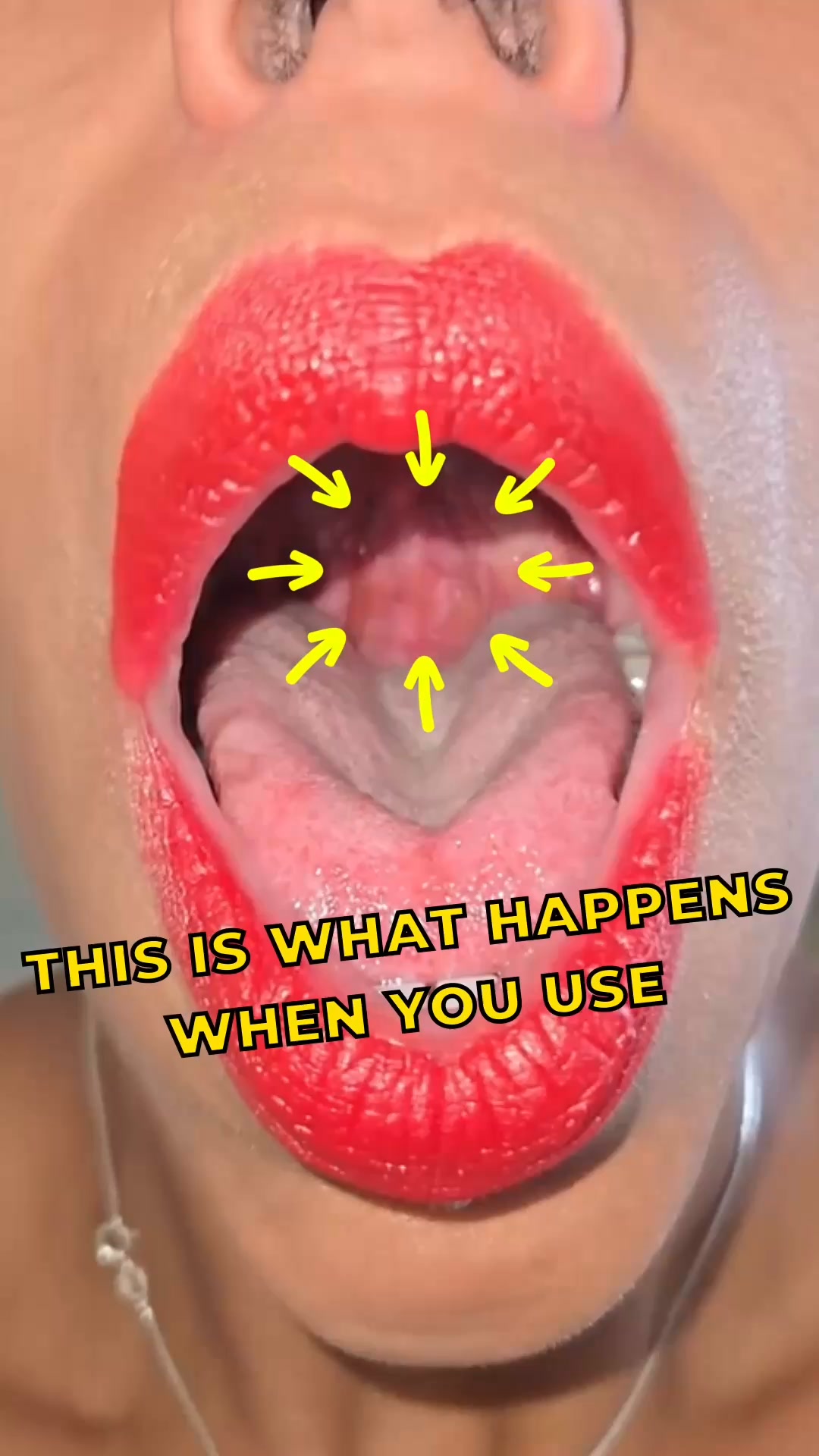 Fix Snoring & Sleepless Nights