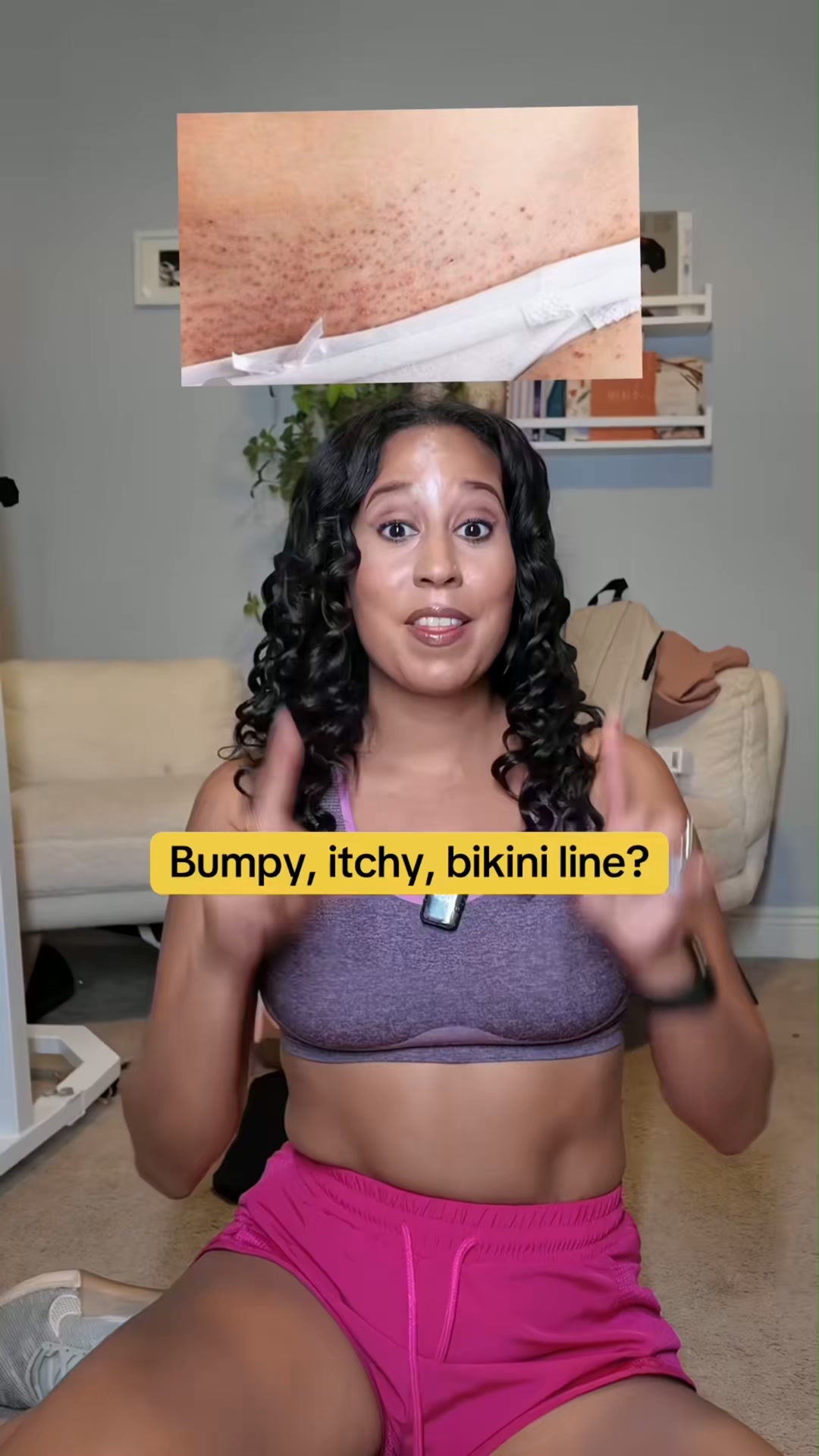 If Your Bikini Line Itches Like Crazy After Waxing—Use This First.