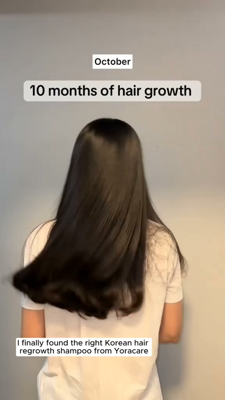 Korean Hair Growth Bar — Stop Hair Loss With 12 Herbs