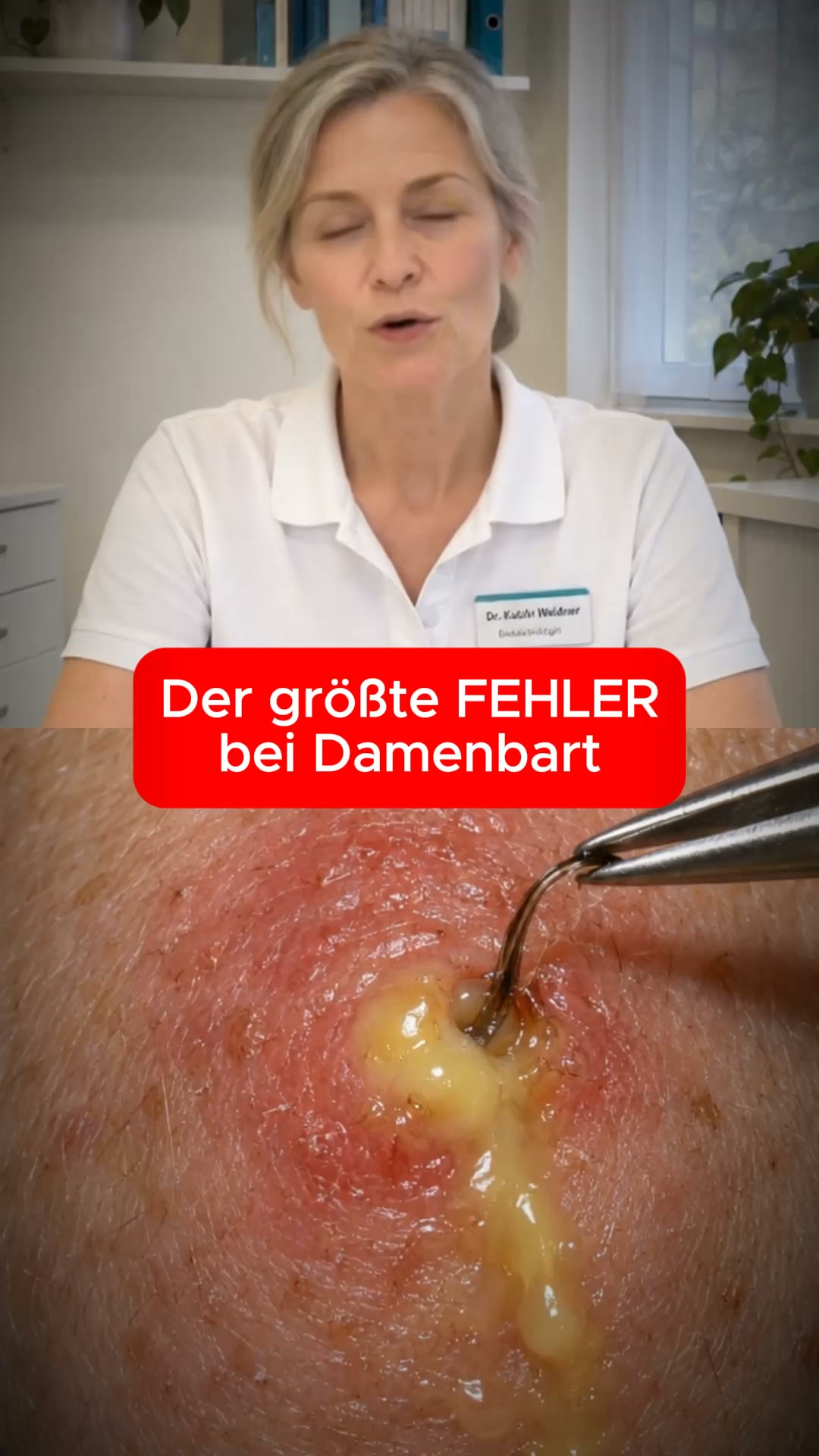 Damenbart und NICHTS hilft länger als 1 Tag?