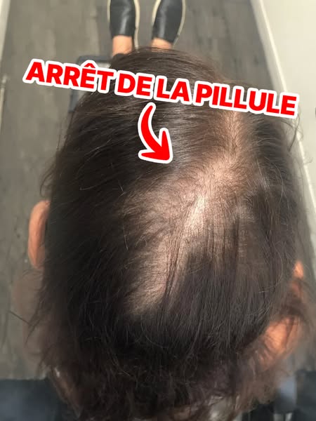 Stoppez votre chute à la racine