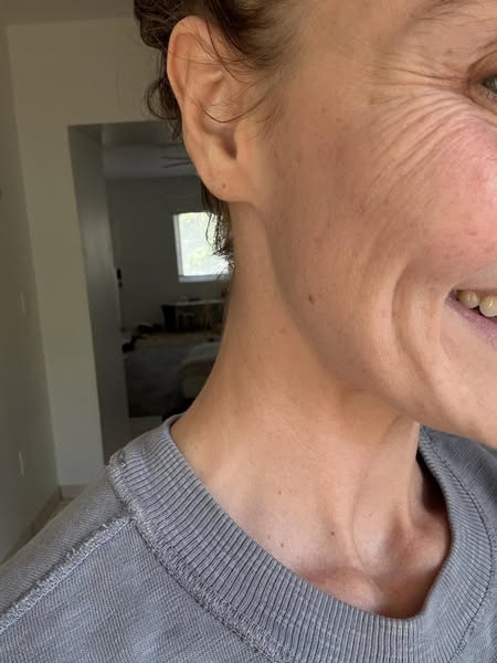 You Won't Need Botox After You Read This