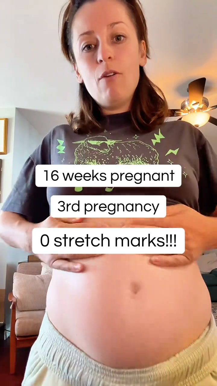 Say Goodbye to Stretch Marks