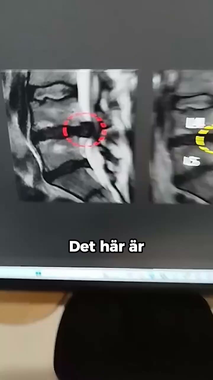 3 sätt att lindra ryggsmärta