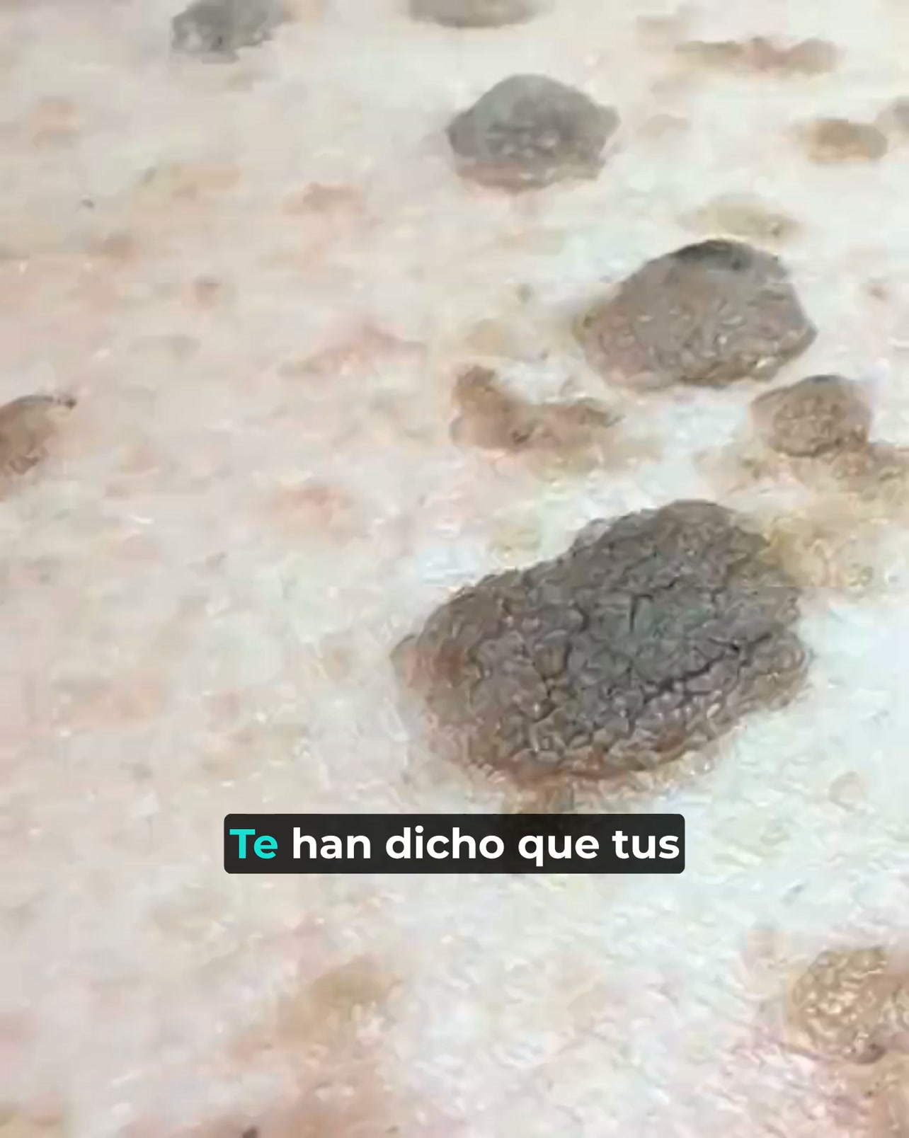Un gesto. Sin aclarado. Piel renovada.