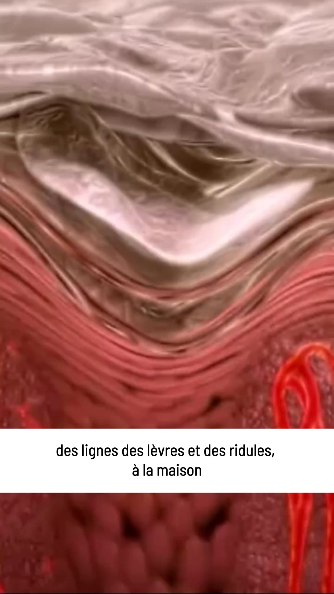Micro-Infusion : une seconde jeunesse pour votre peau