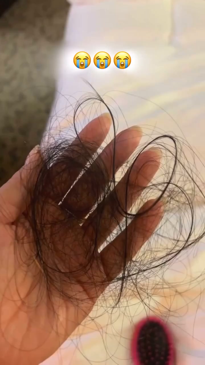 Hair Transplant Clinic