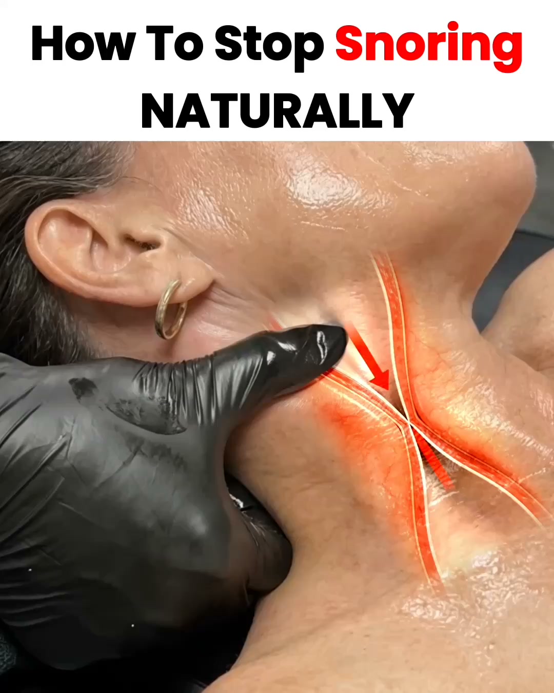 The smarter way to stop snoring!