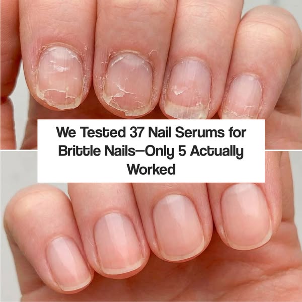 5 Nail Serums PUT To The Test
