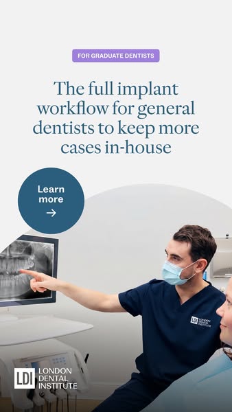 Keep implant cases in-house