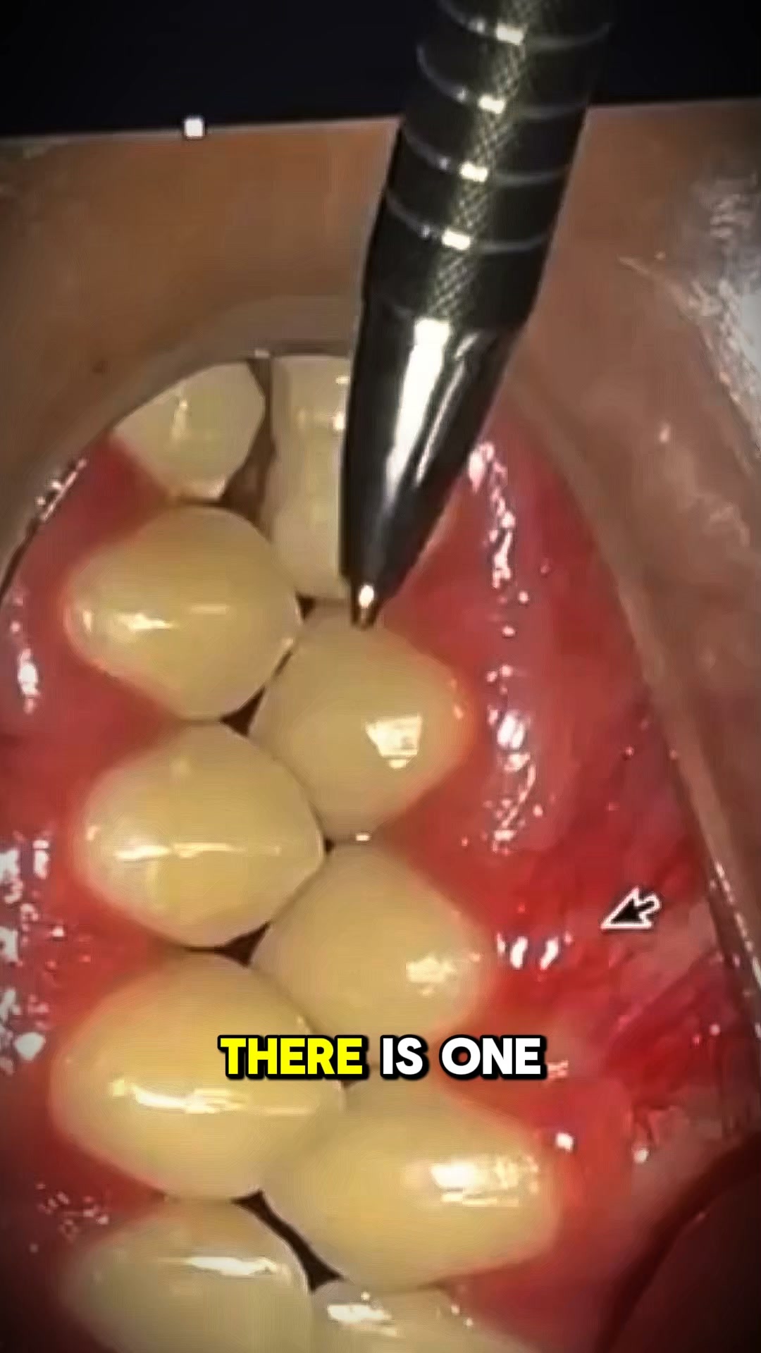 The mistake isn’t in the technique.
It’s in the decision.