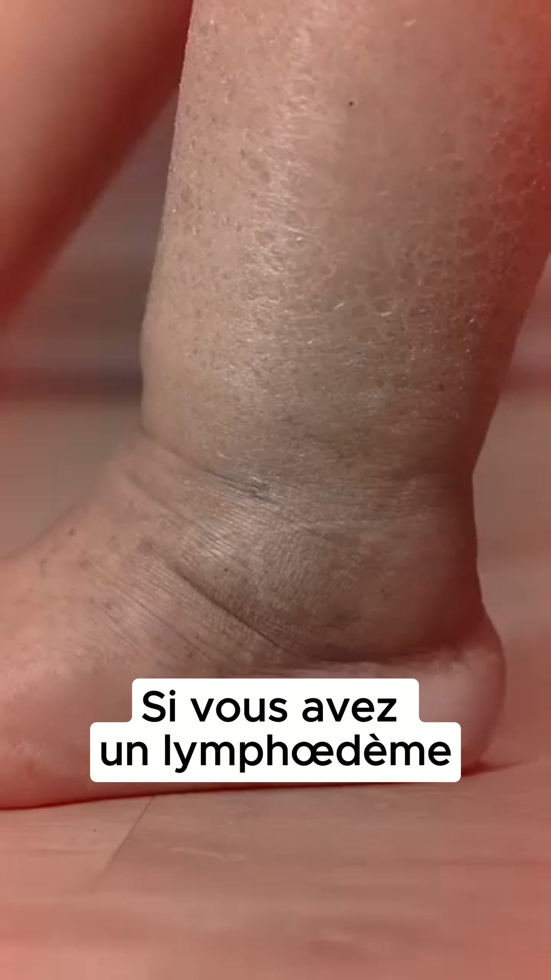 Les douleurs aux jambes et aux pieds, c’est du passé !