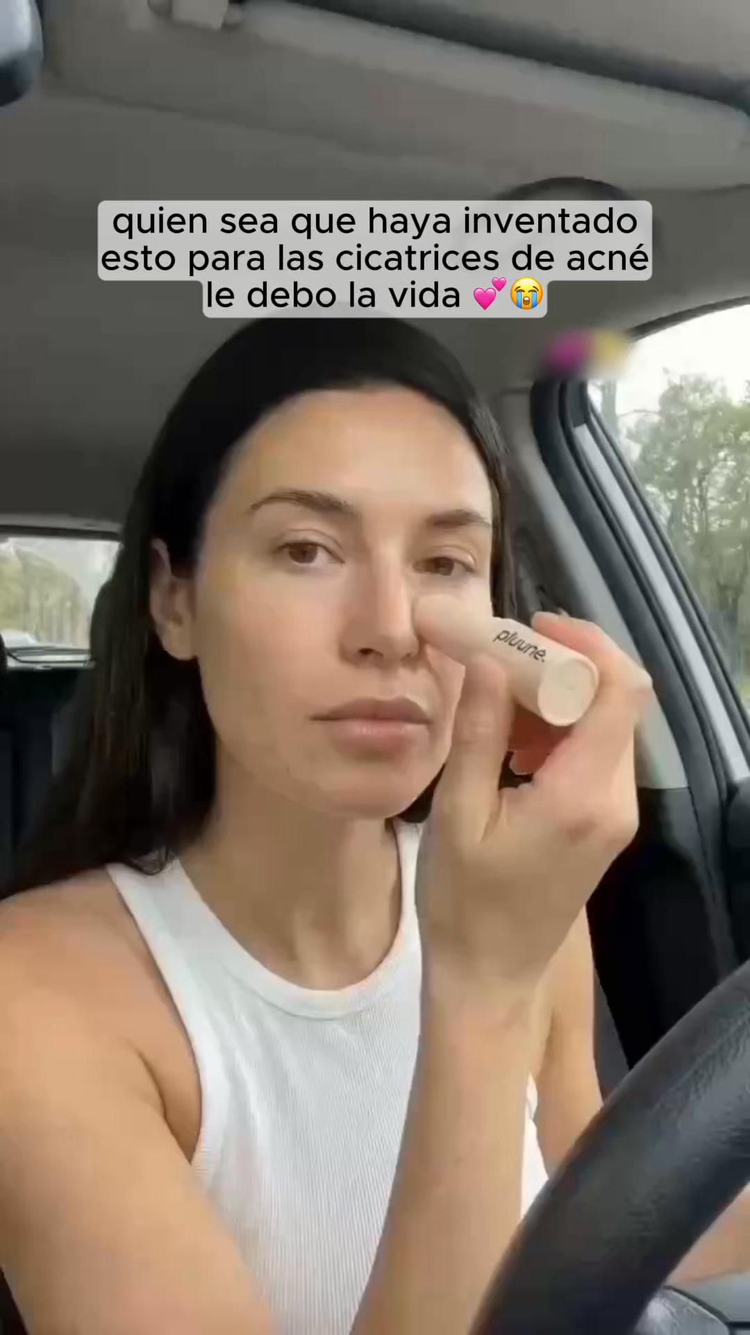 Si Tienes Marcas Mira Esto