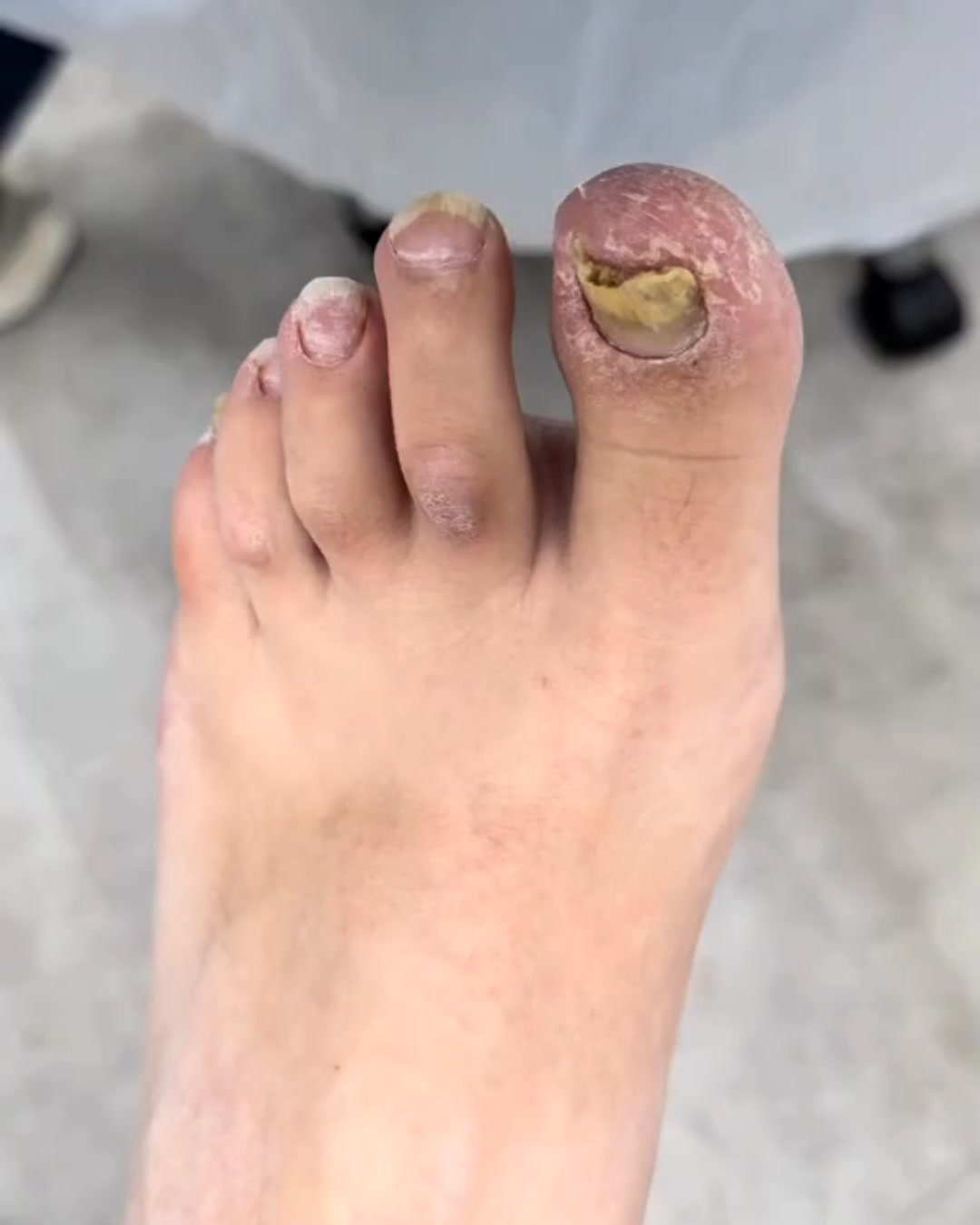 𝐊𝐚𝐮𝐧𝐢𝐢𝐦𝐦𝐚𝐧 𝐧𝐚̈𝐤𝐨̈𝐢𝐬𝐞𝐭 𝐤𝐲𝐧𝐧𝐞𝐭