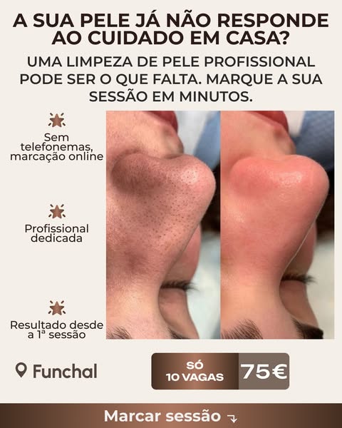 Veja o que uma sessão faz pela sua pele