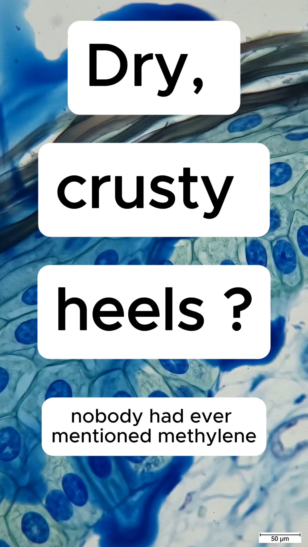 Methylene Blue For Dy Cracked Heels. Here's Why