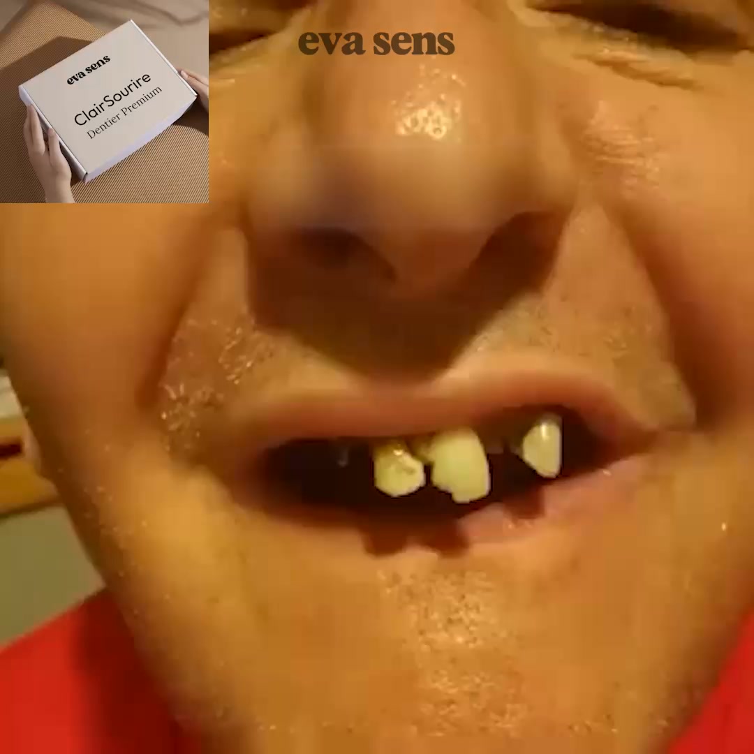 Un sourire naturel instantanément!