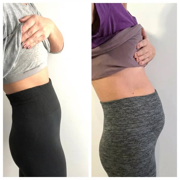 I'm a midwife: that's not fat
