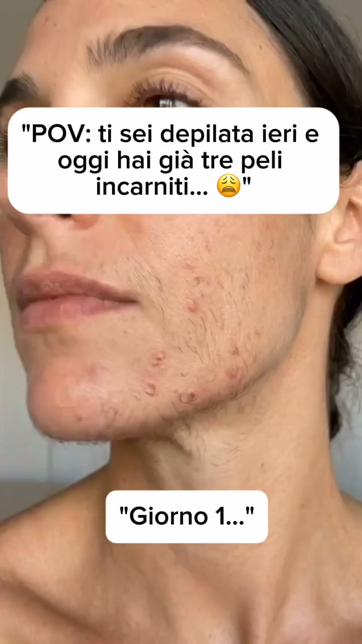 Addio peli sul viso