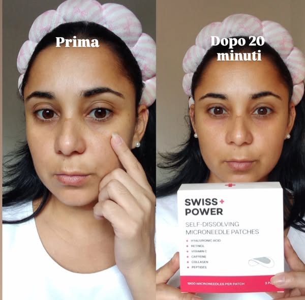 Cerotti innovativi con micro-aghi
