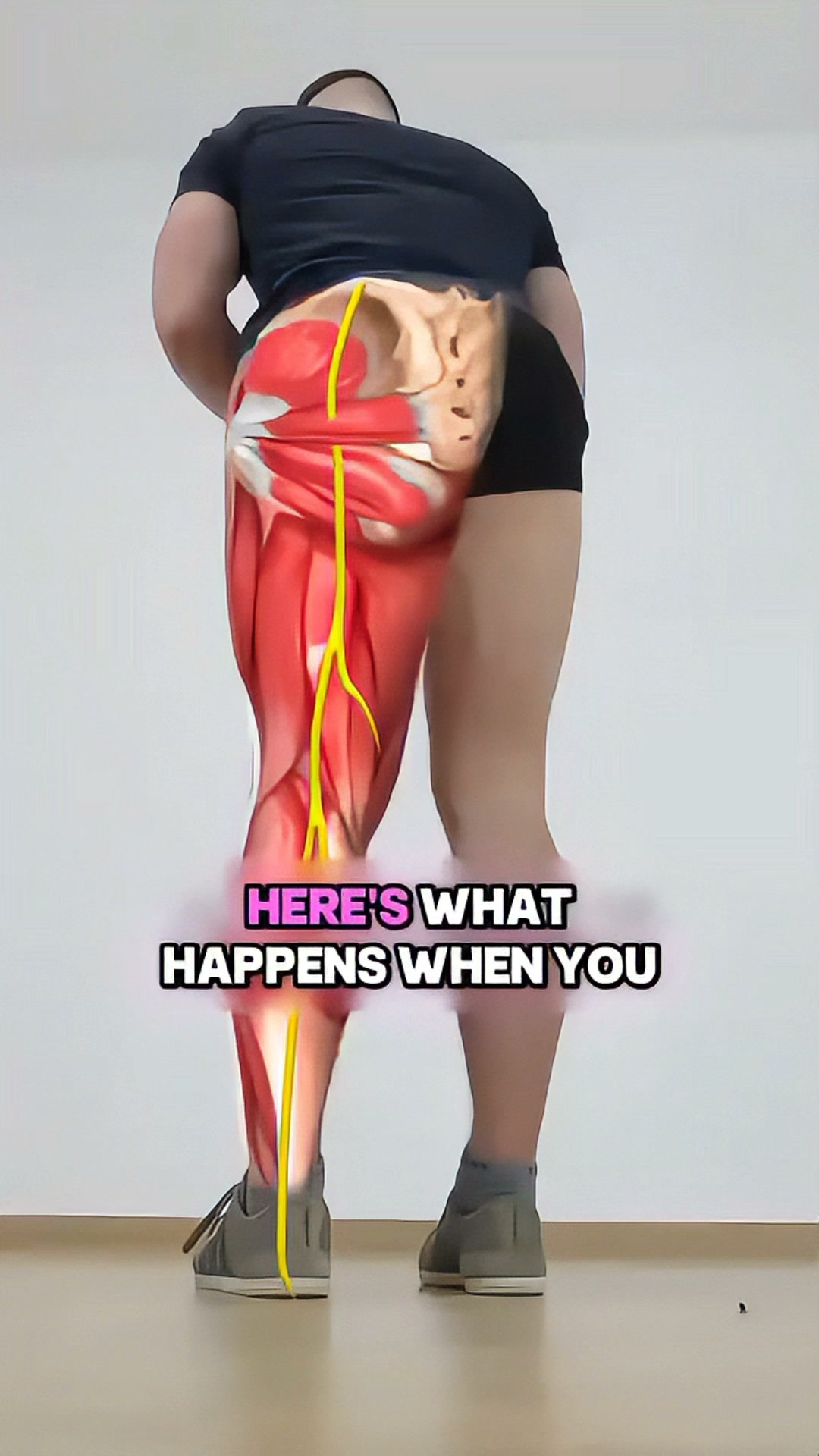Put an End to Sciatic Nerve Pain for Good?