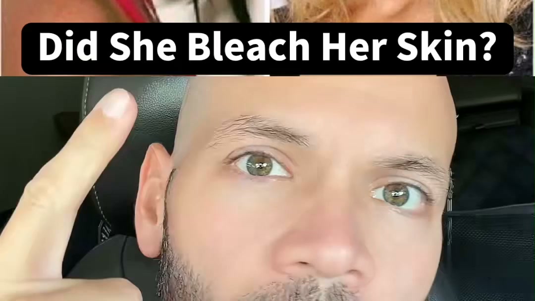 Brighter Skin in 2 Weeks