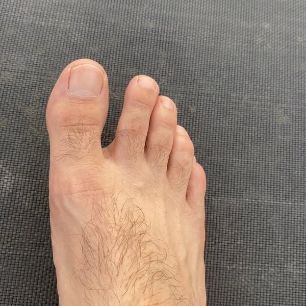 I Didn't Know It Could Spread
