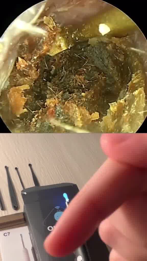BASTONCILLOS HOLA TECNOLOGÍA