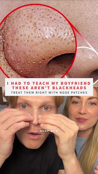 No More Nose Bumps