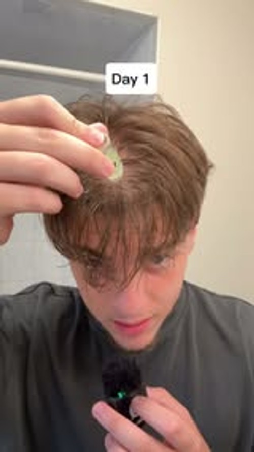 Restore your hair!